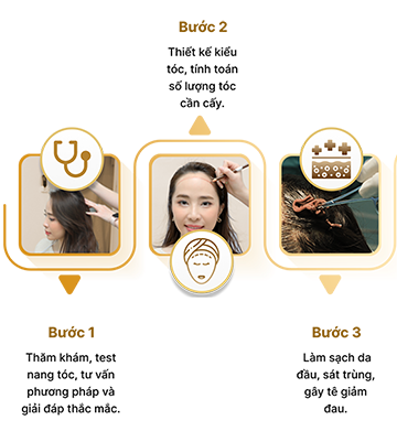 Cấy tóc việt nam