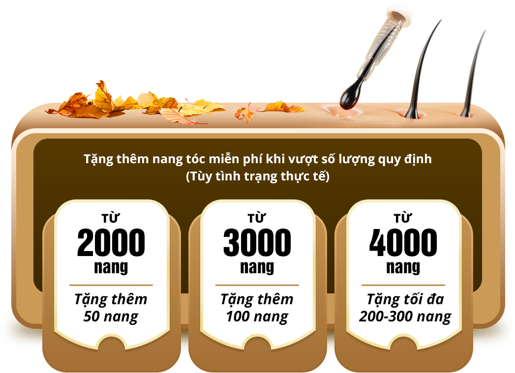 cấy ghép tóc y học hà nội