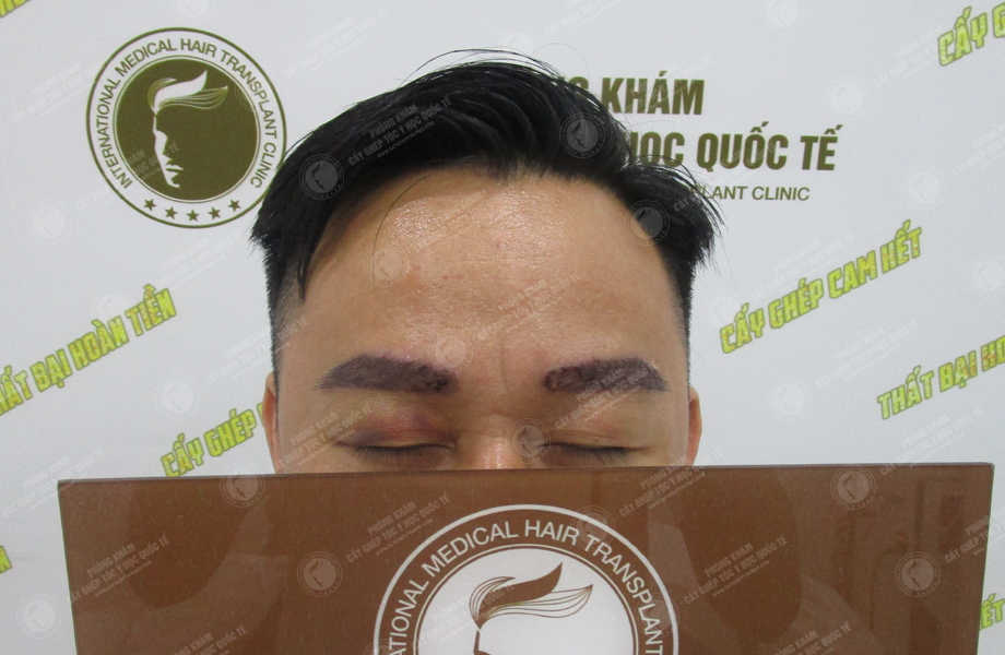 Đỗ Đình Khởi -  4