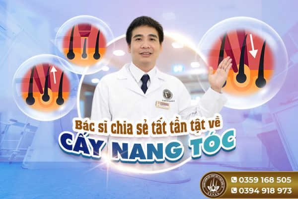 Bác sĩ chia sẻ tất tần tật về cấy nang tóc