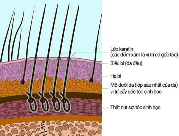 Tóc sinh học có cấu tạo 3 lớp như tóc thật