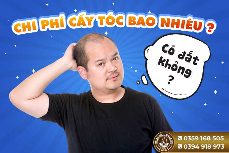 Chi phí cấy tóc bao nhiêu? Có đắt không?