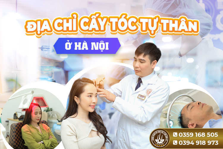 Địa chỉ cấy tóc tự thân ở Hà Nội uy tín – an toàn – hiệu quả