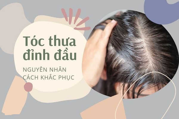 [Cảnh báo] 6+Nguyên Nhân gây tóc thưa ở đỉnh đầu nữ