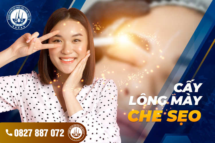 Cấy lông mày che sẹo – Phương pháp thẩm mỹ siêu HOT