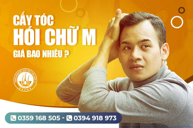 Cấy tóc hói chữ M giá bao nhiêu? Có đắt không?