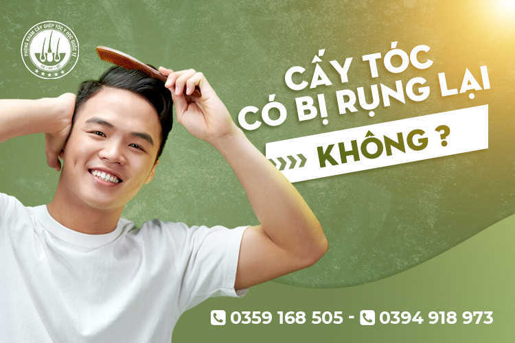 Cấy tóc có bị rụng lại không? Giải đáp từ chuyên gia