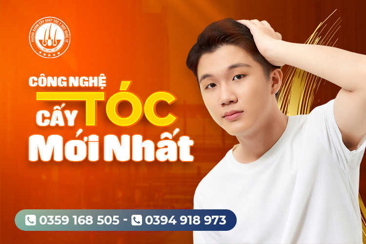 Công nghệ cấy tóc mới nhất: Khôi phục mái tóc dày đẹp tự nhiên