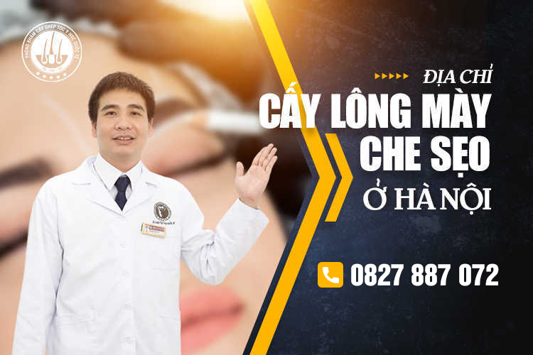 Phòng khám Cấy ghép tóc Y học Quốc tế – Địa chỉ cấy lông mày che sẹo ở Hà Nội