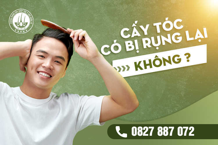 Cấy tóc có bị rụng lại không? Giải đáp từ chuyên gia
