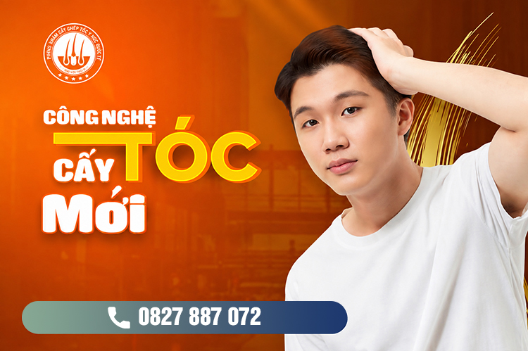 Công nghệ cấy tóc mới : Khôi phục mái tóc dày đẹp tự nhiên
